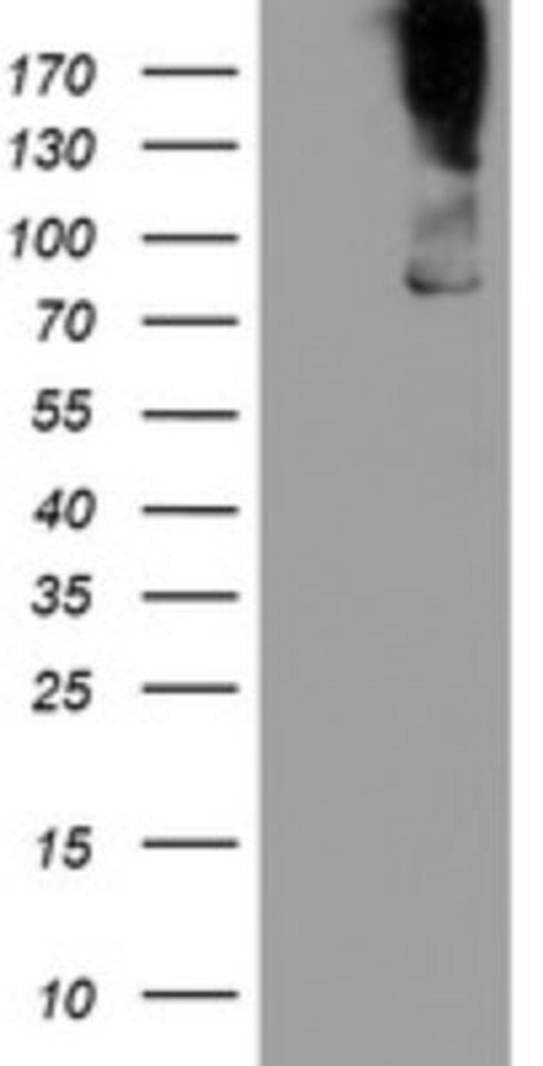 Western Blot: DREF Antibody (5A2) [NBP2-46383] - Analysis of HEK293T cells were transfected with the pCMV6-ENTRY control (Left lane) or pCMV6-ENTRY DREF.