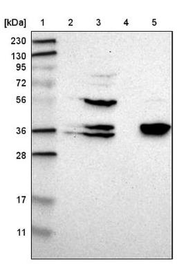 Western Blot: CGR19 Antibody [NBP1-85644] - Lane 1: Marker [kDa] 230, 130, 95, 72, 56, 36, 28, 17, 11<br/>Lane 2: Human cell line RT-4<br/>Lane 3: Human cell line U-251MG sp<br/>Lane 4: Human plasma (IgG/HSA depleted)<br/>Lane 5: Human liver tissue