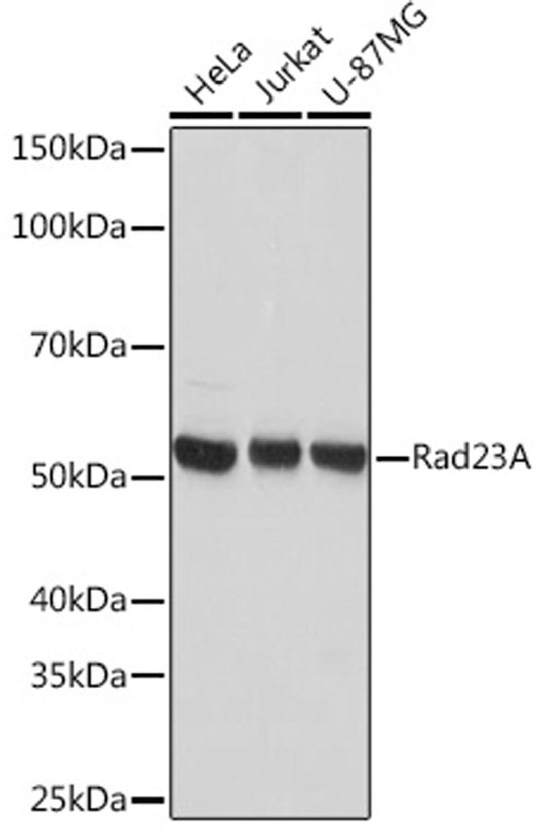 Western blot - Rad23A Rabbit mAb (A5147)