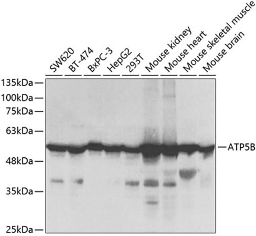 Western blot - ATP5B Antibody (A5769)