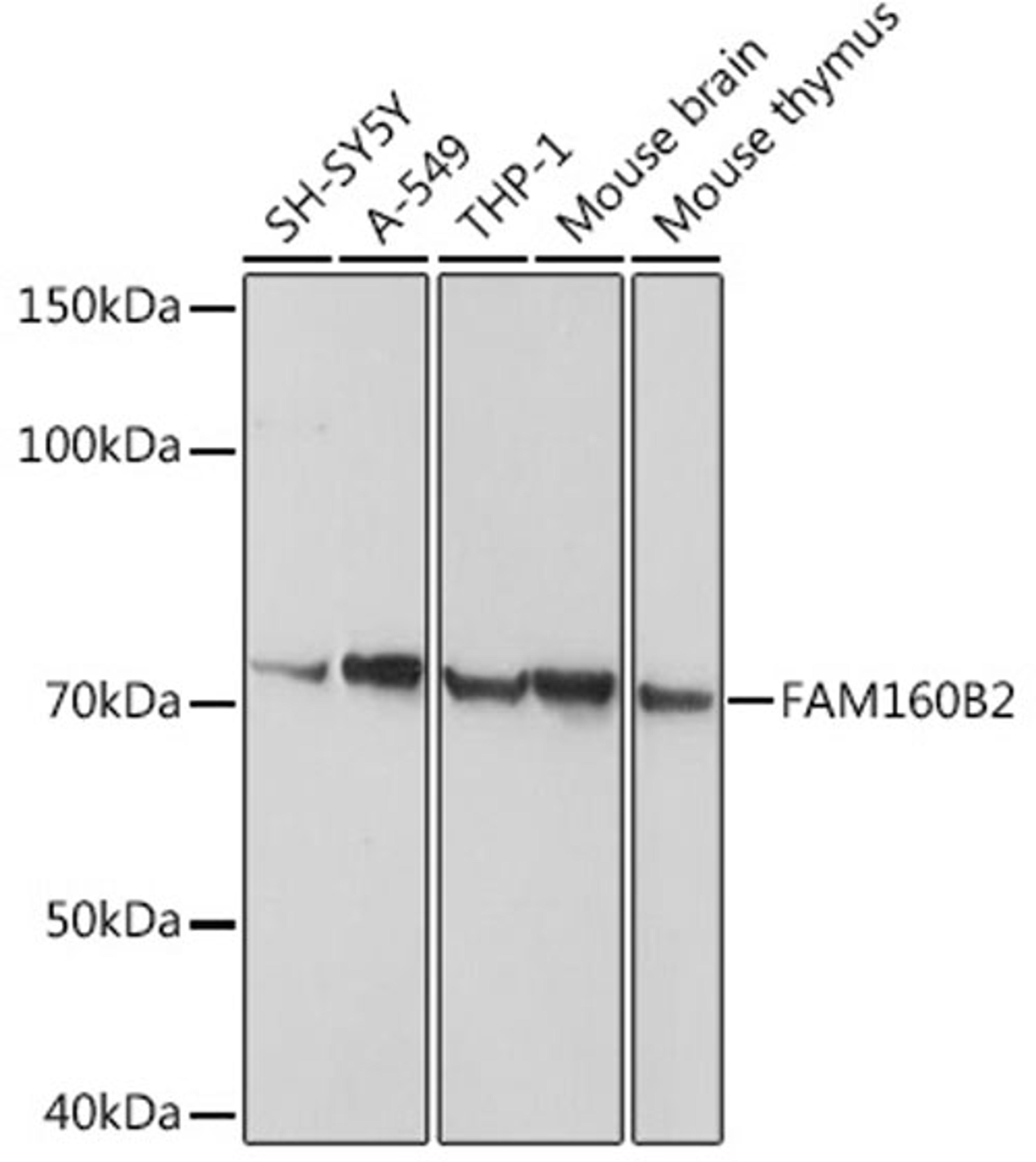 Western blot - FAM160B2 antibody (A3192)