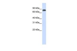 Antibody used in WB on Human Lung at 0.2-1 ug/ml.