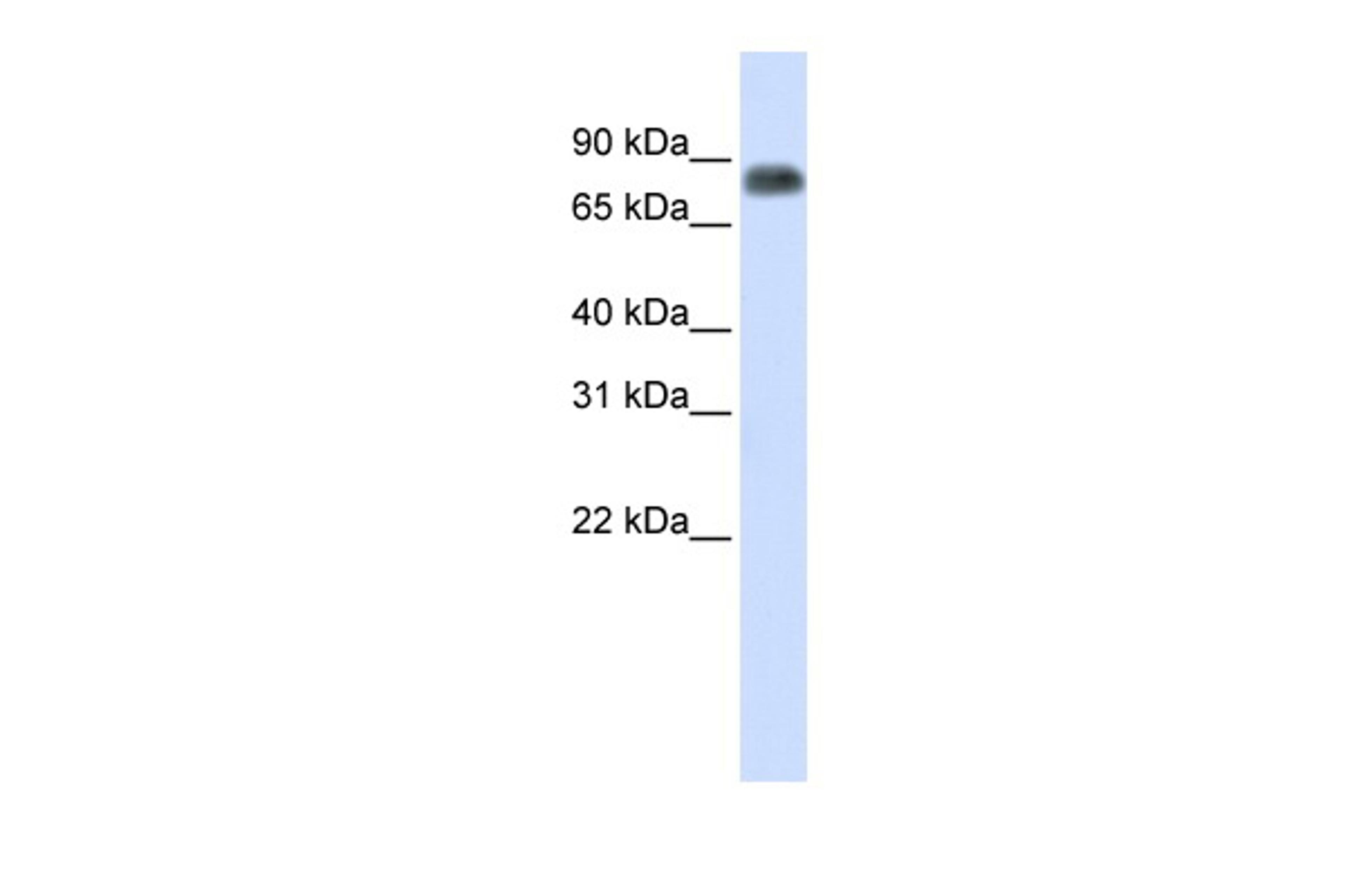 Antibody used in WB on Human Lung at 0.2-1 ug/ml.