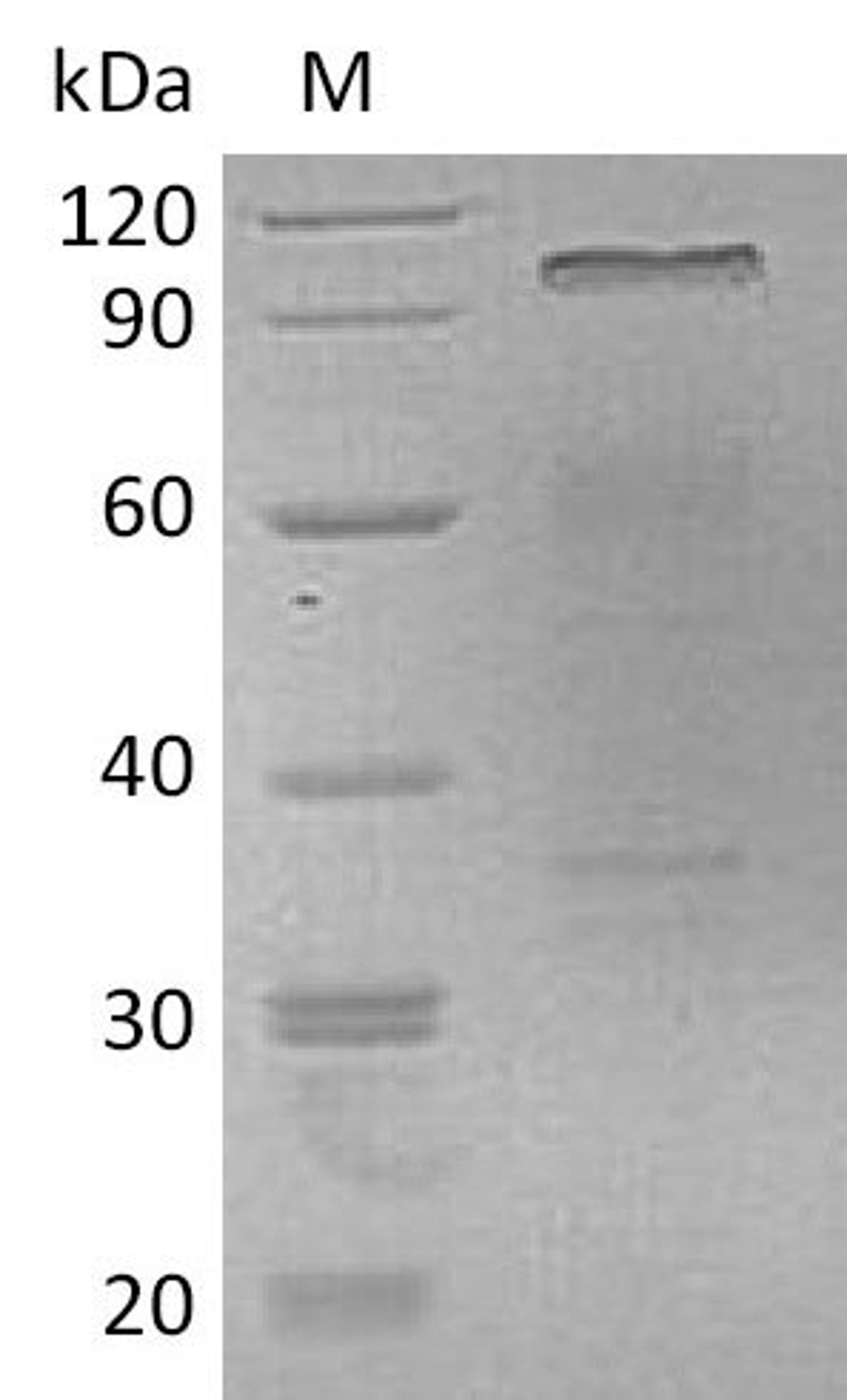 (Tris-Glycine gel) Discontinuous SDS-PAGE (reduced) with 5% enrichment gel and 15% separation gel.