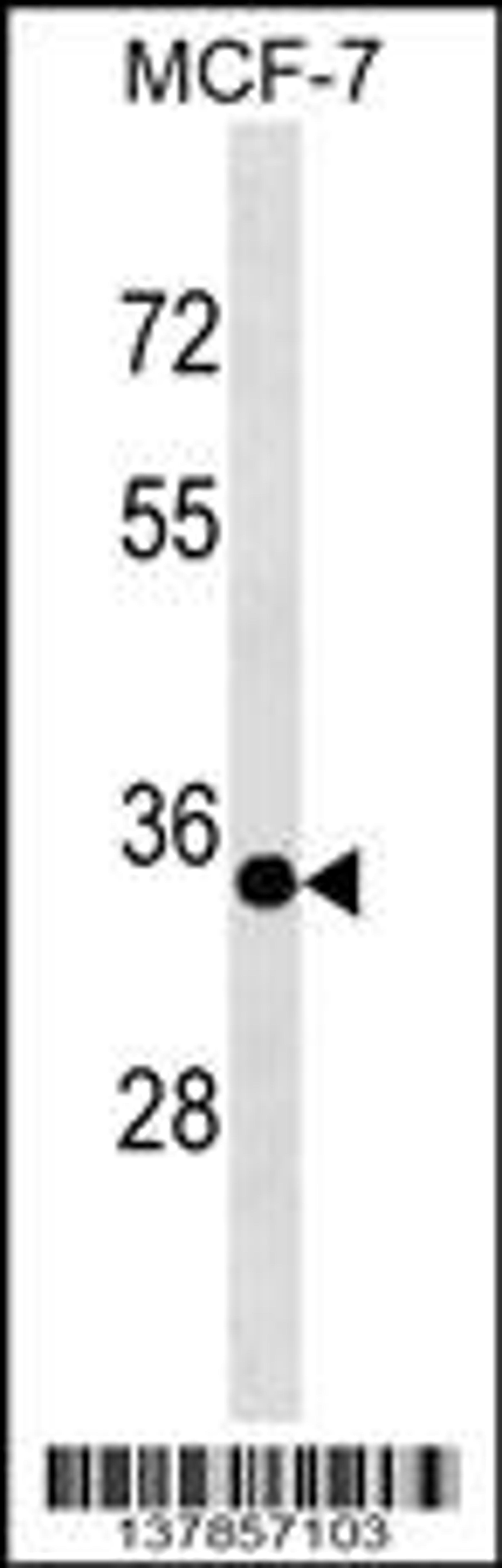 Western blot analysis in MCF-7 cell line lysates (35ug/lane).