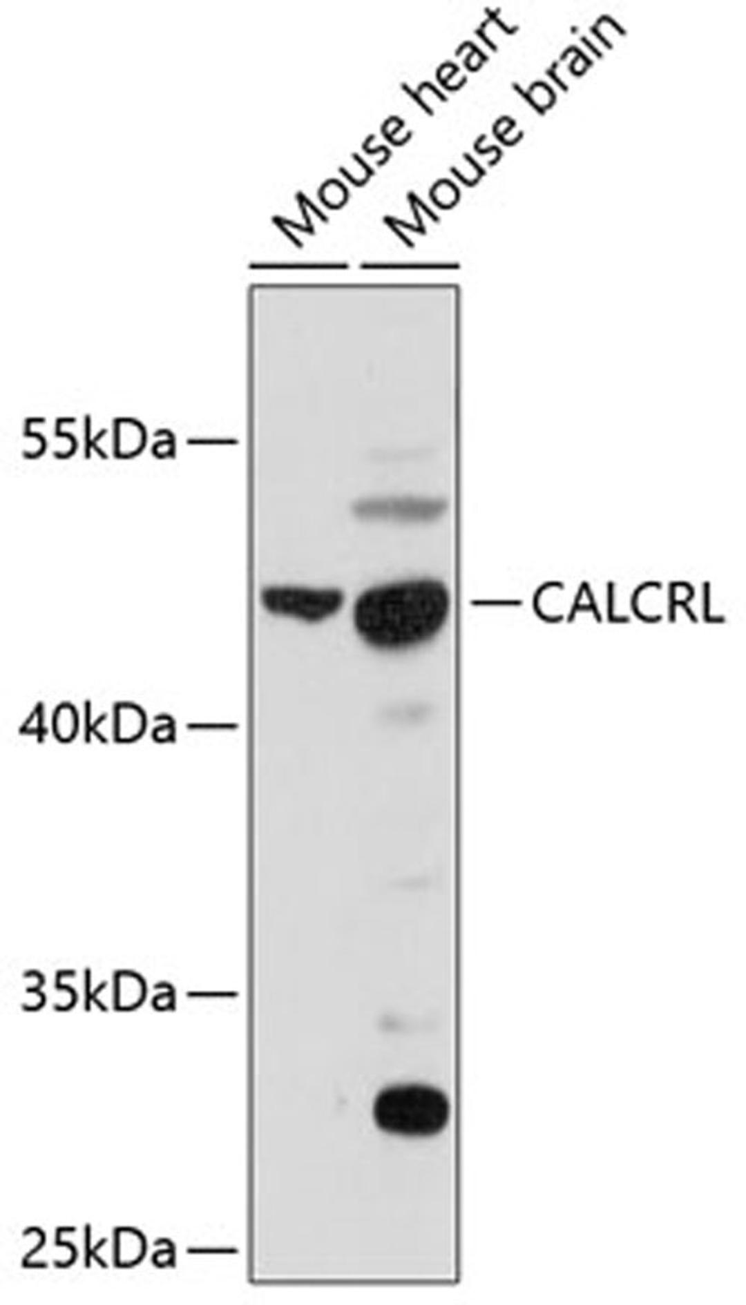 Western blot - CALCRL antibody (A11979)