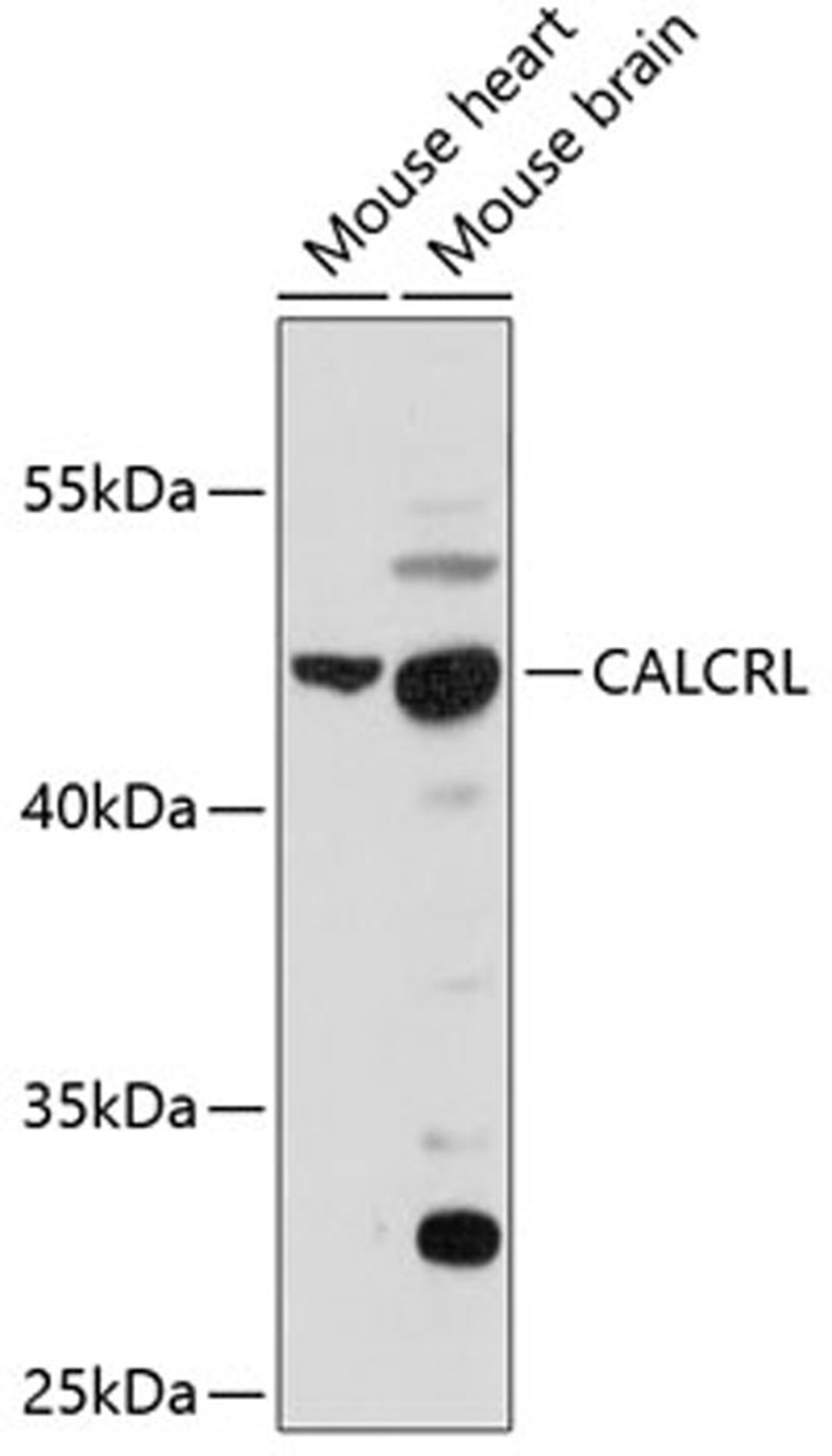 Western blot - CALCRL antibody (A11979)