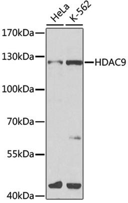 Western blot - HDAC9 antibody (A1516)