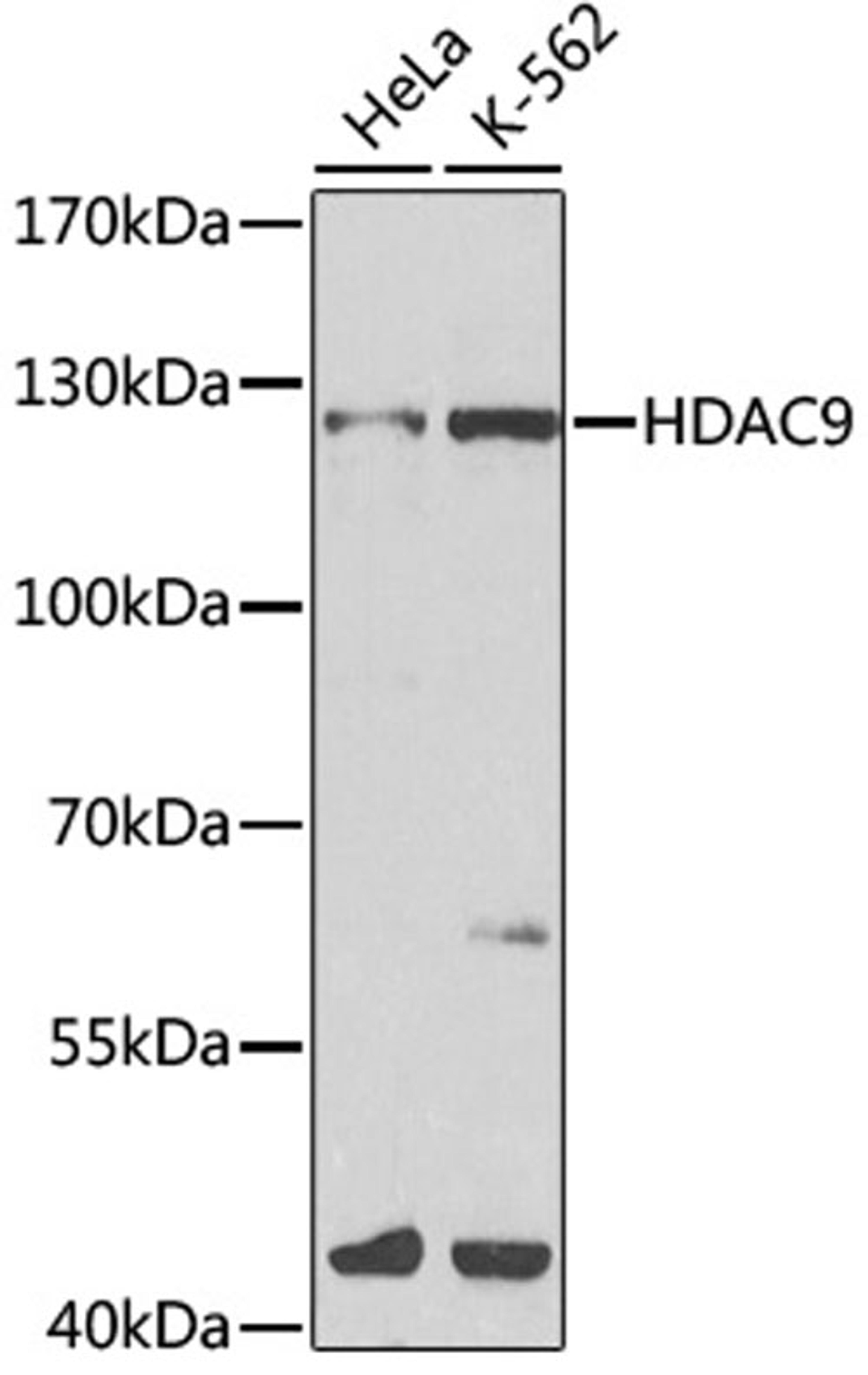 Western blot - HDAC9 antibody (A1516)