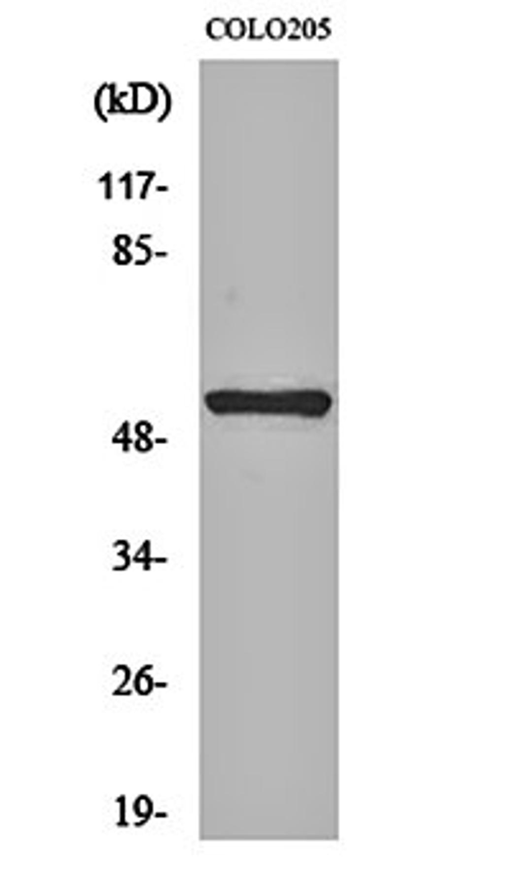 Western blot analysis of COLO205 cell lysates using NK-3R antibody