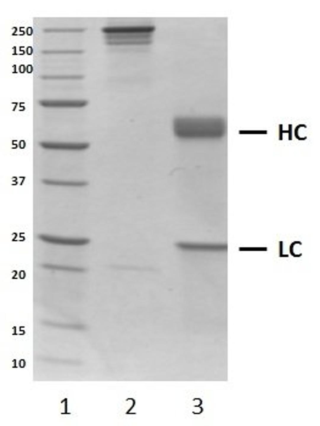 SDS-PAGE analysis of recombinant Human IgA1 kappa