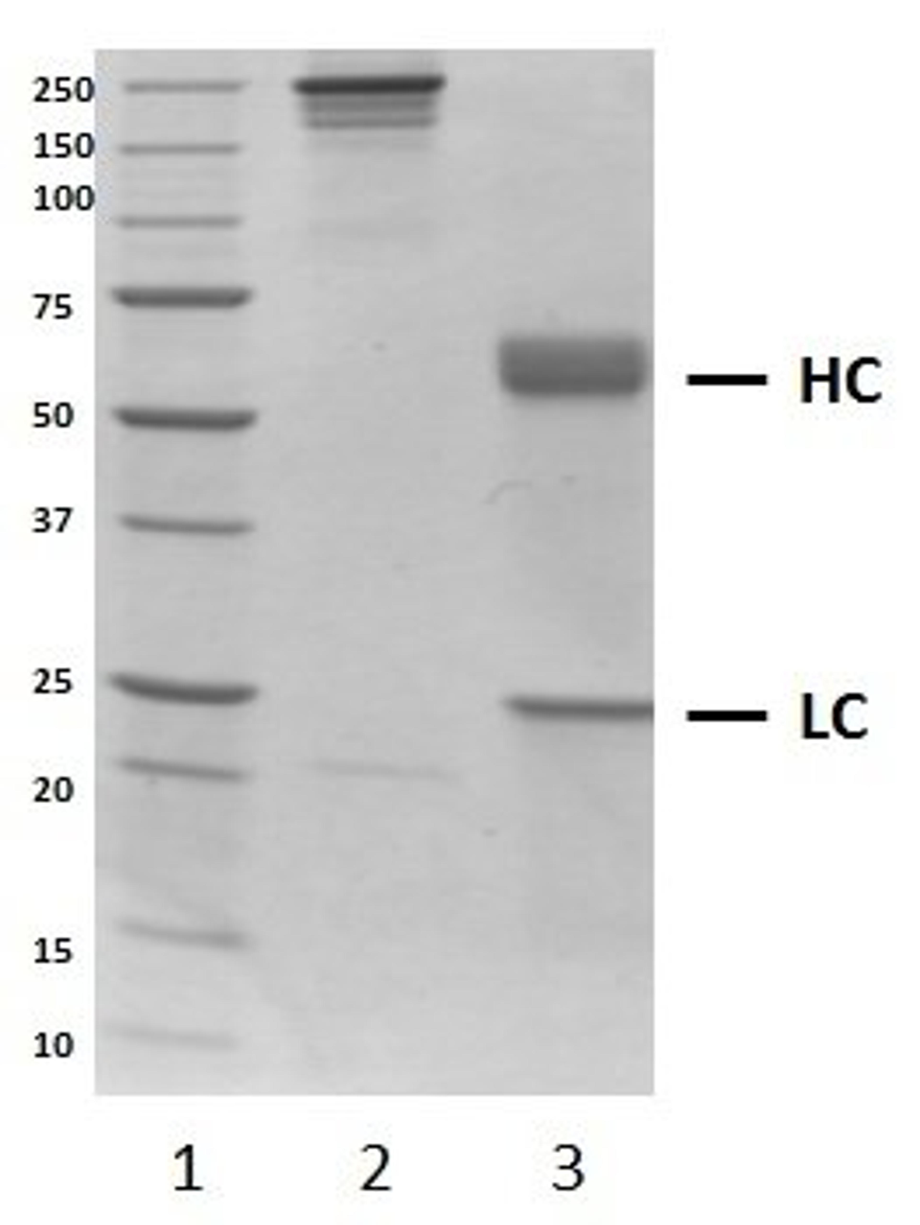 SDS-PAGE analysis of recombinant Human IgA1 kappa