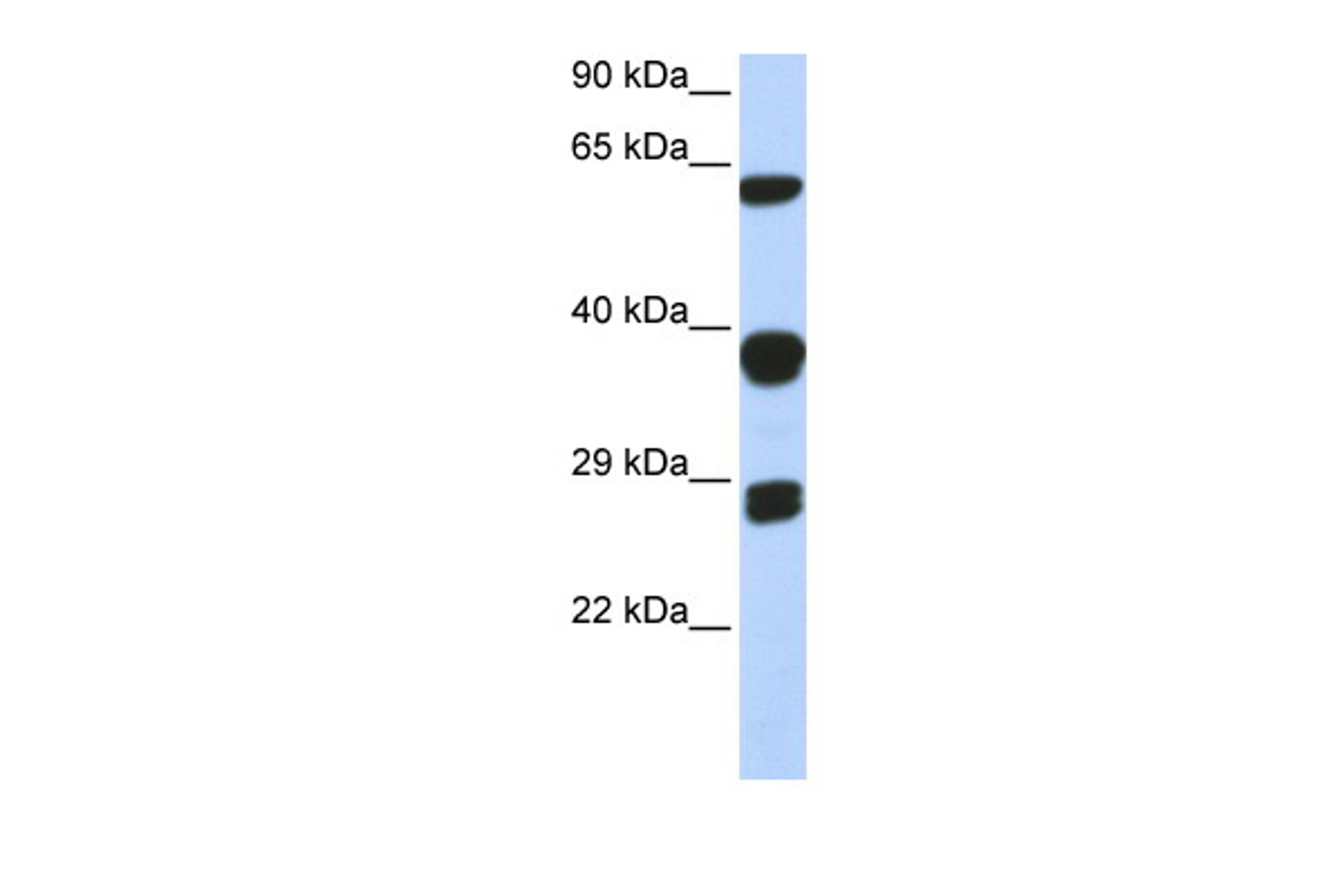 Antibody used in WB on Human HEK293T cells at 0.2-1 ug/ml.