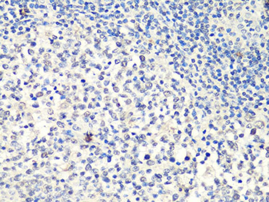 Immunohistochemistry  - MTA2 Antibody (A10980)