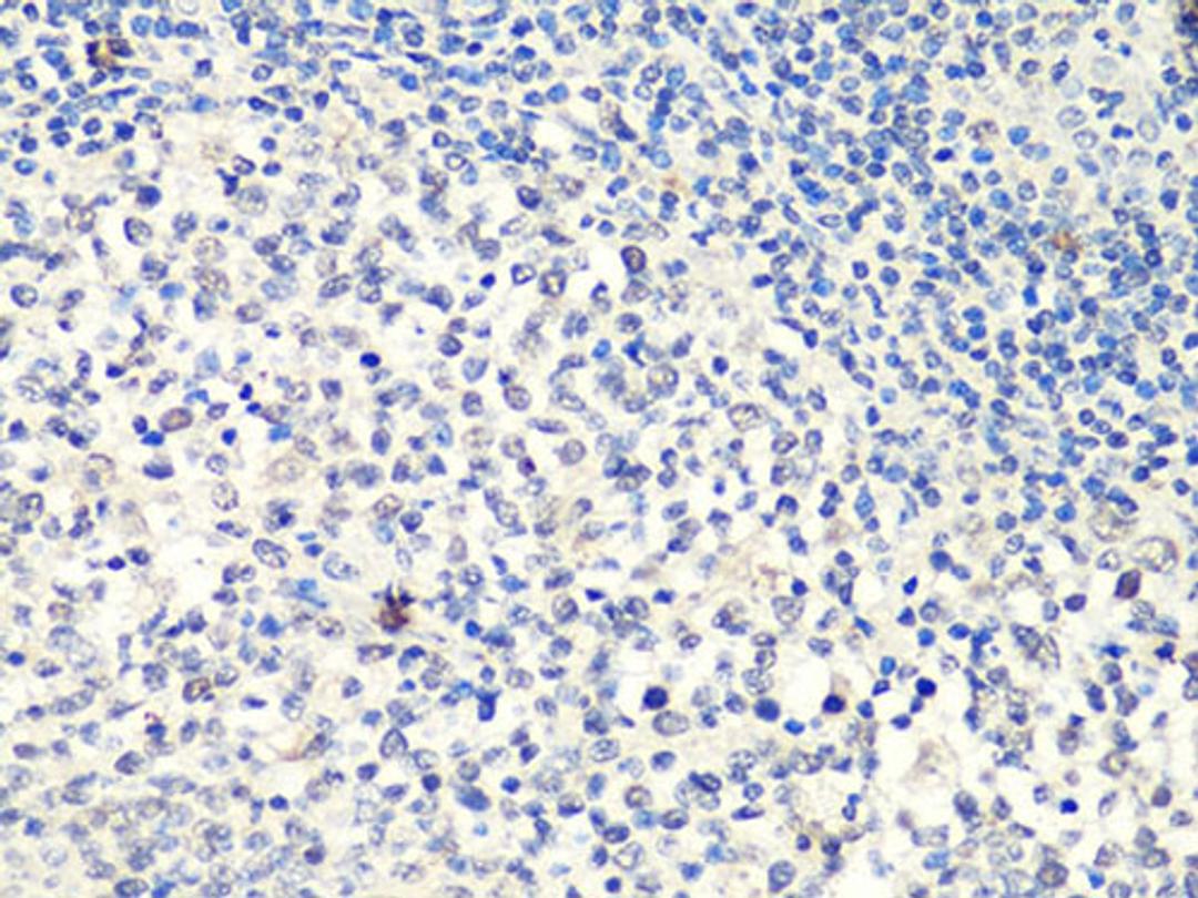 Immunohistochemistry - MTA2 Antibody (A10980)