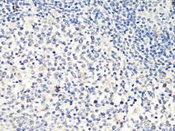 Immunohistochemistry - MTA2 Antibody (A10980)