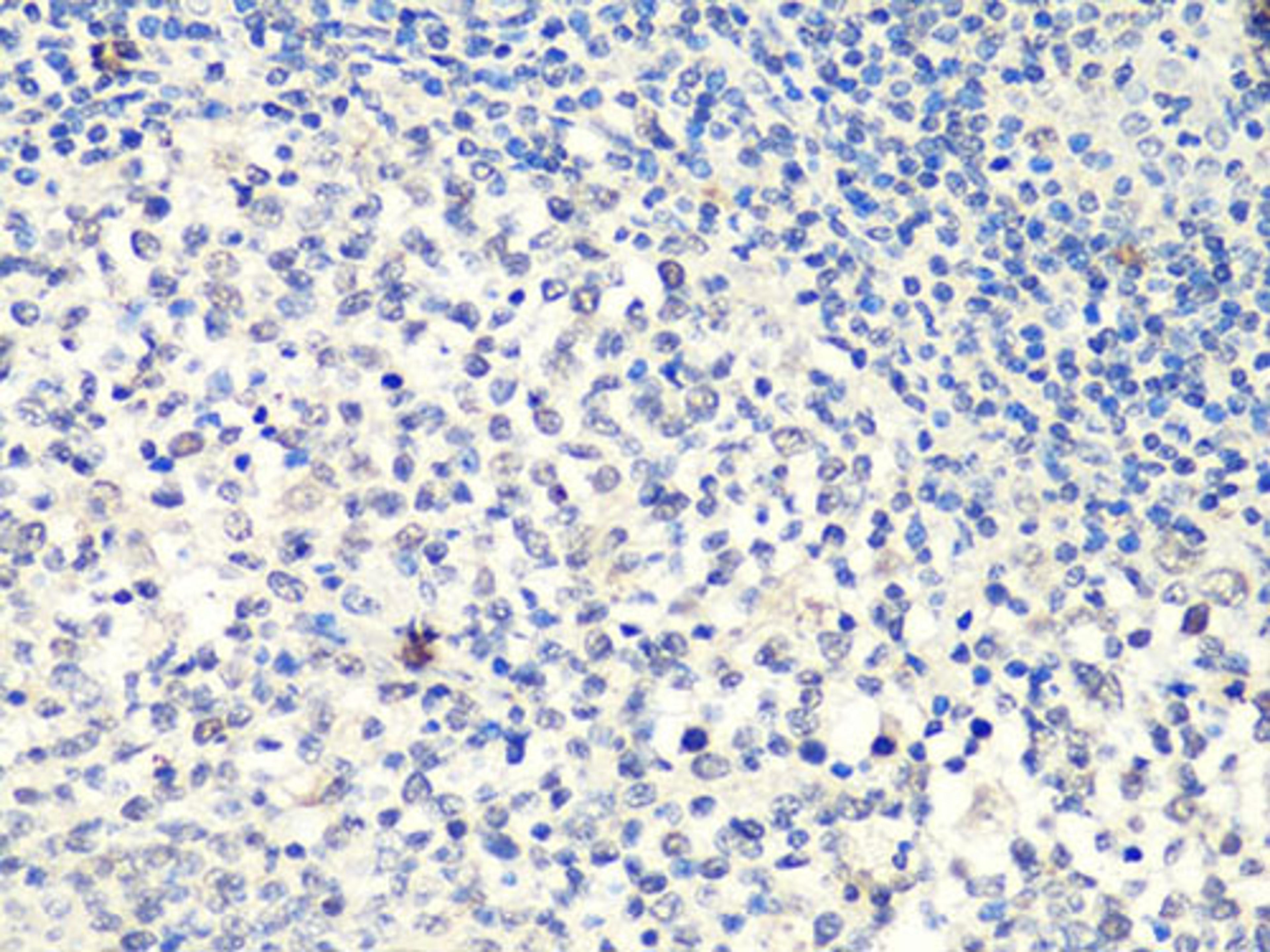 Immunohistochemistry - MTA2 Antibody (A10980)