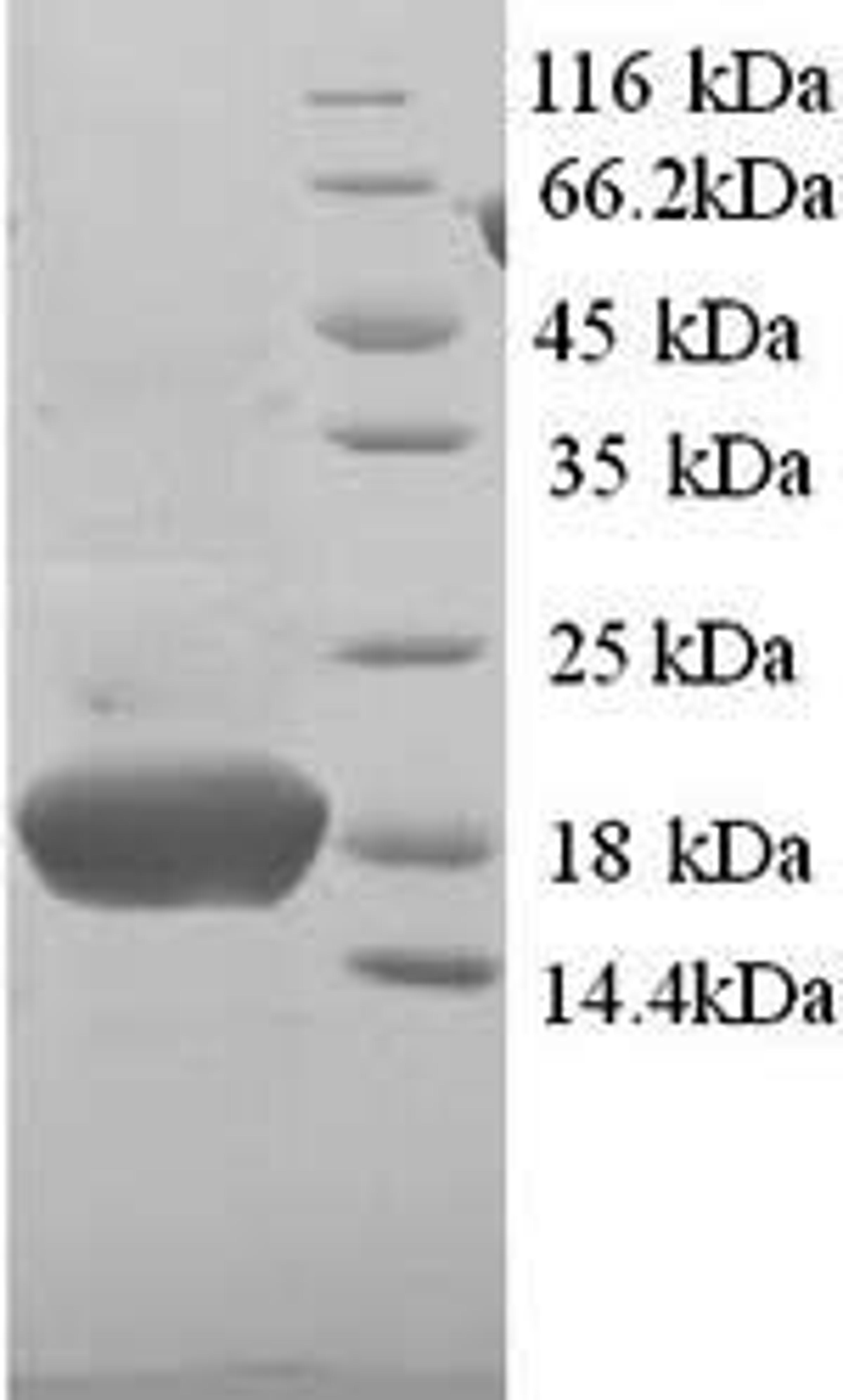 (Tris-Glycine gel) Discontinuous SDS-PAGE (reduced) with 5% enrichment gel and 15% separation gel.