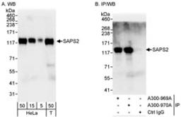 Detection of human SAPS2 by western blot and immunoprecipitation.