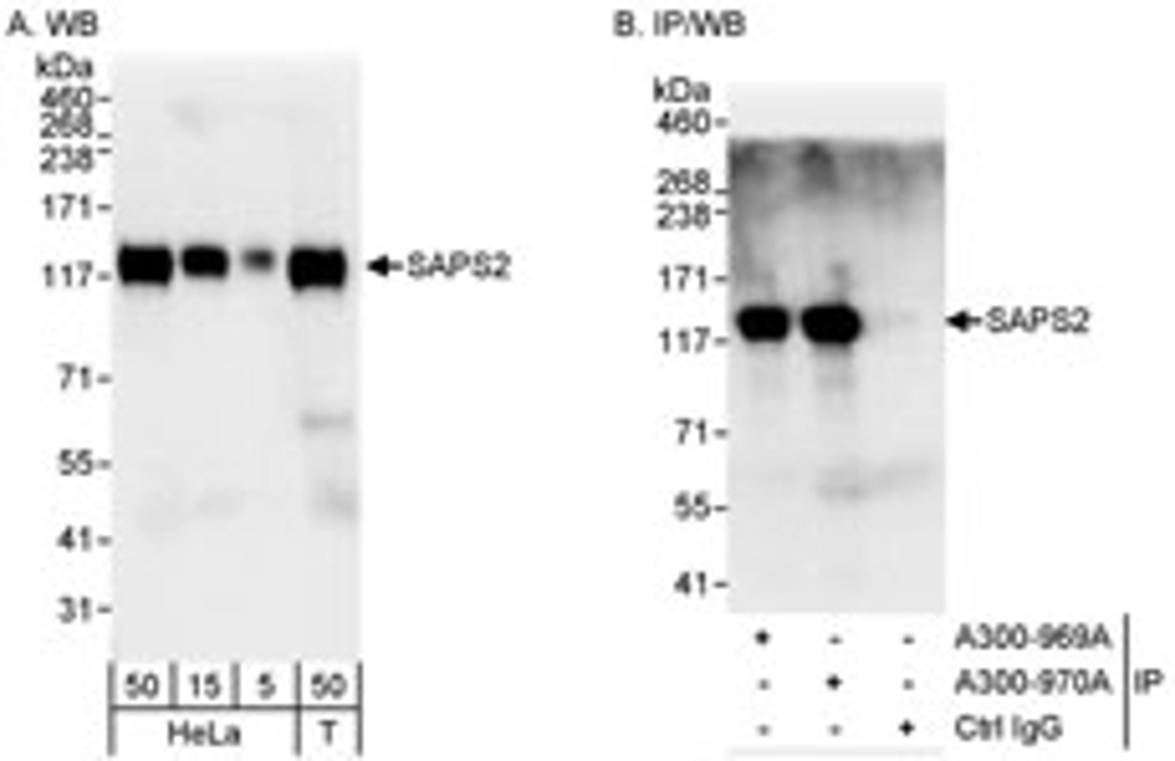 Detection of human SAPS2 by western blot and immunoprecipitation.