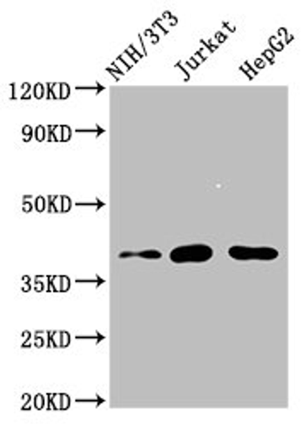 Western Blot. Positive WB detected in: NIH/3T3 whole cell lysate, Jurkat whole cell lysate, HepG2 whole cell lysate. All lanes: RNF2 antibody at 4µg/ml. Secondary. Goat polyclonal to rabbit IgG at 1/50000 dilution. Predicted band size: 38, 30 kDa. Observed band size: 38 kDa