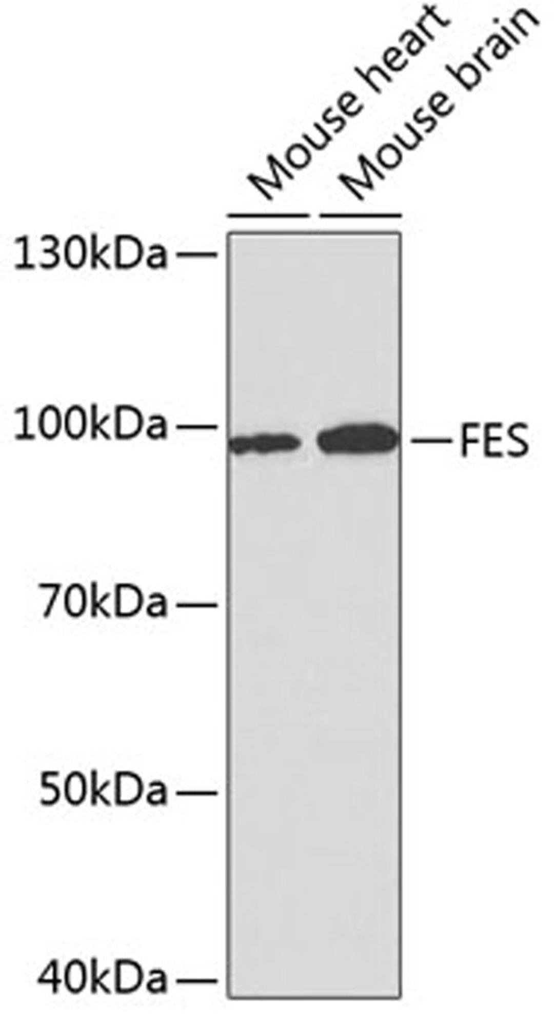 Western blot - FES antibody (A2578)