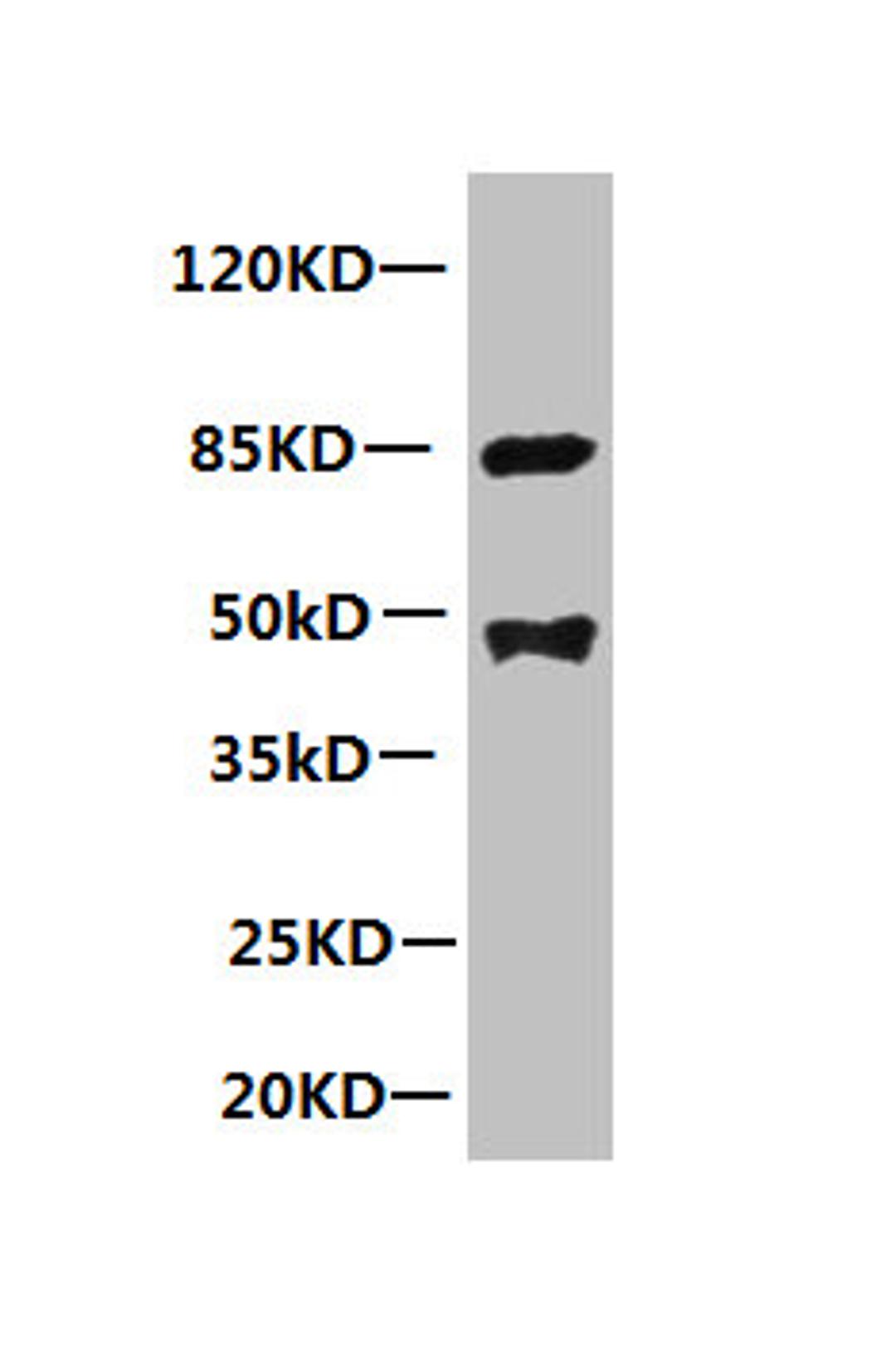 All lanes: Mouse anti-human Platelet-activating factor acetylhydrolase monoclonal Antibody at 1ug/ml. Lane 1:mouse spleen tissue. Secondary:HRP labeled Goat polyclonal to Mouse IgG at 1/3000 dilution. Predicted band size : 48kd. Observed band size : 44kd. Additional bands at: 85kd. 