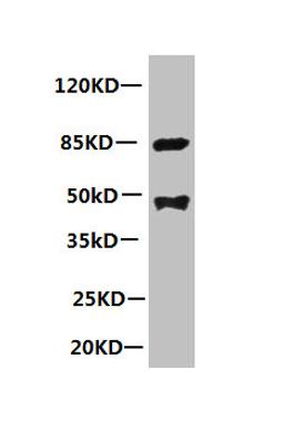 All lanes: Mouse anti-human Platelet-activating factor acetylhydrolase monoclonal Antibody at 1ug/ml. Lane 1:mouse spleen tissue. Secondary:HRP labeled Goat polyclonal to Mouse IgG at 1/3000 dilution. Predicted band size : 48kd. Observed band size : 44kd. Additional bands at: 85kd. 