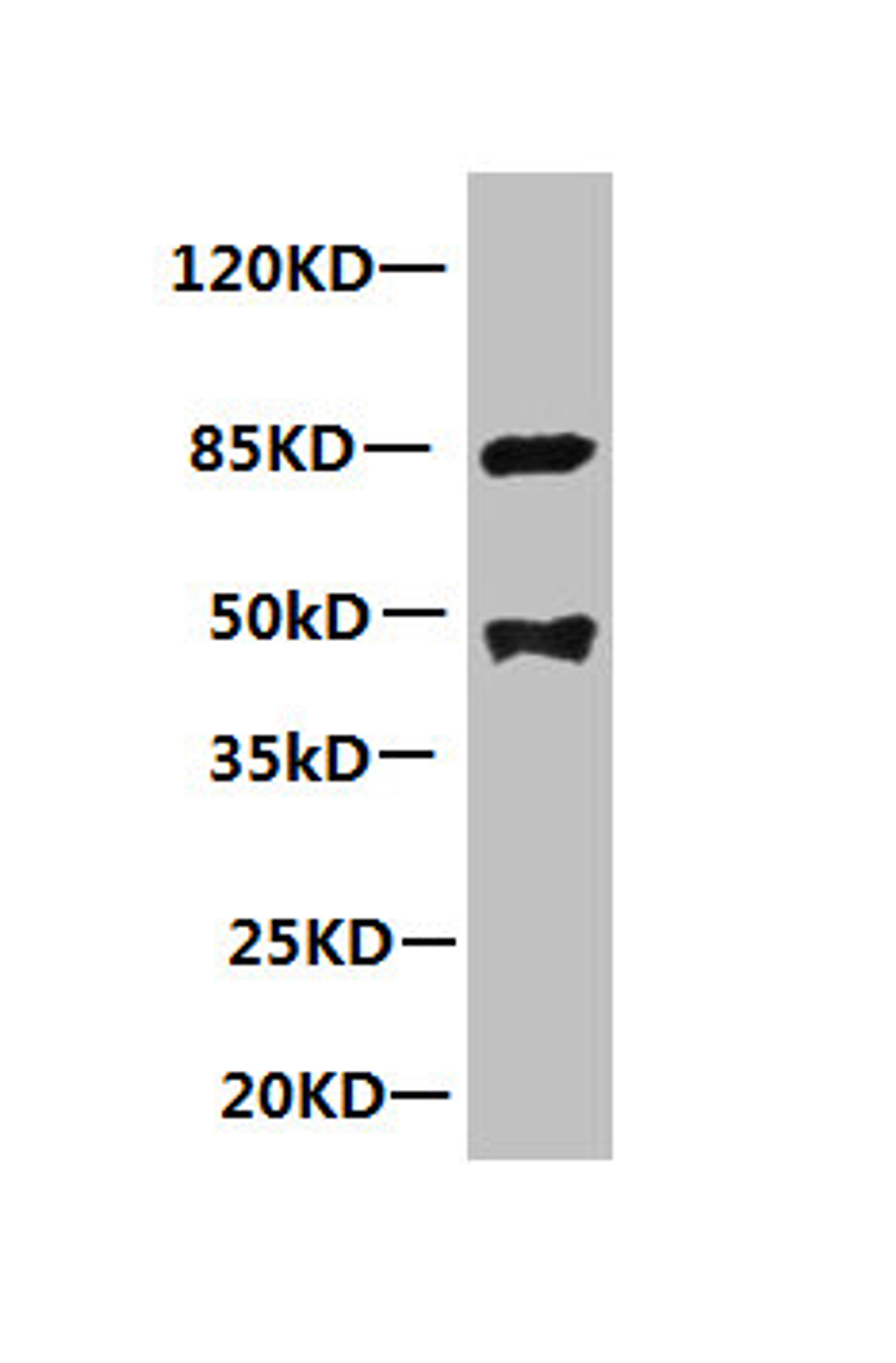 All lanes: Mouse anti-human Platelet-activating factor acetylhydrolase monoclonal Antibody at 1ug/ml. Lane 1:mouse spleen tissue. Secondary:HRP labeled Goat polyclonal to Mouse IgG at 1/3000 dilution. Predicted band size : 48kd. Observed band size : 44kd. Additional bands at: 85kd. 