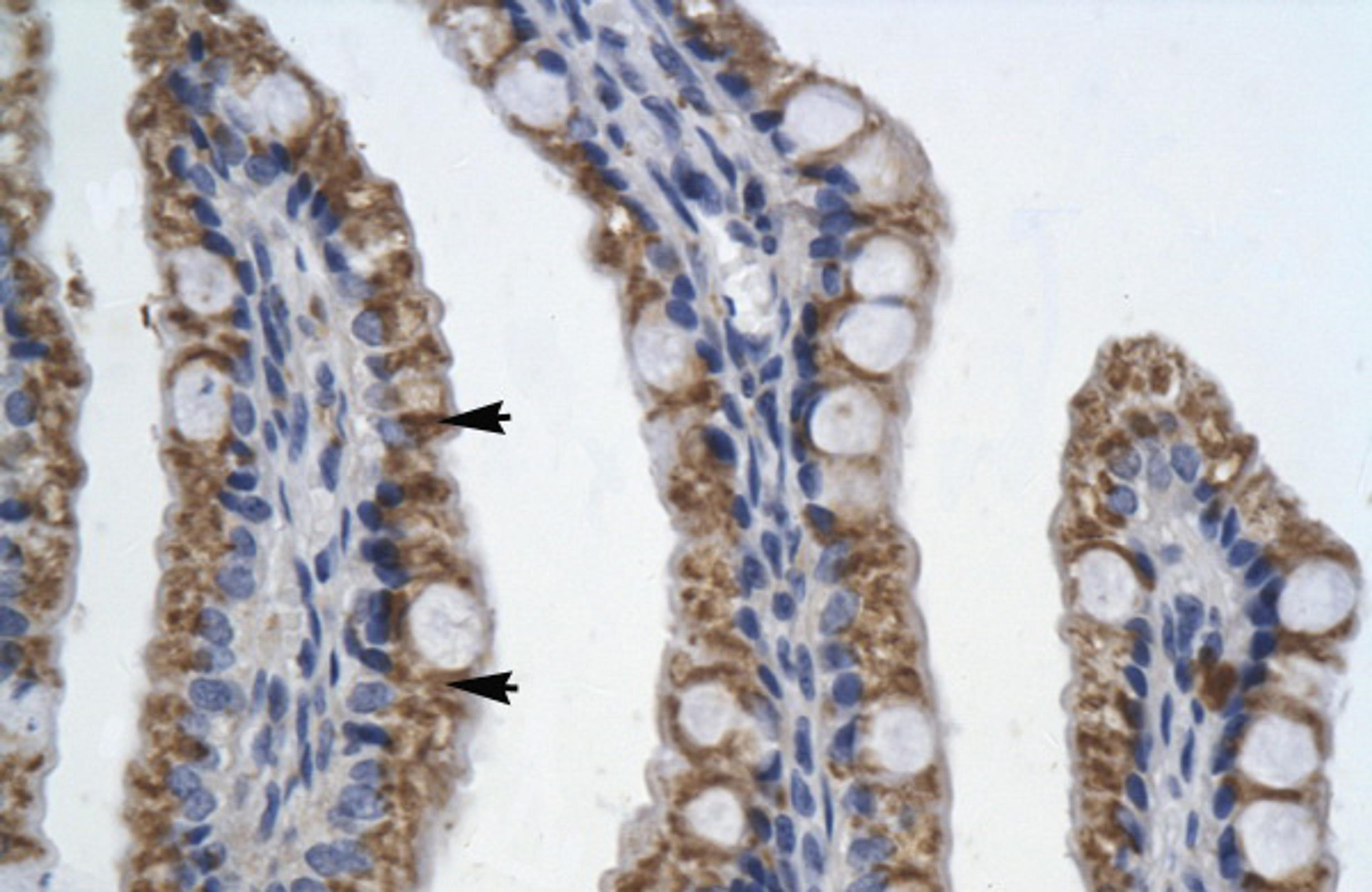 Antibody used in IHC on Human Intestine.