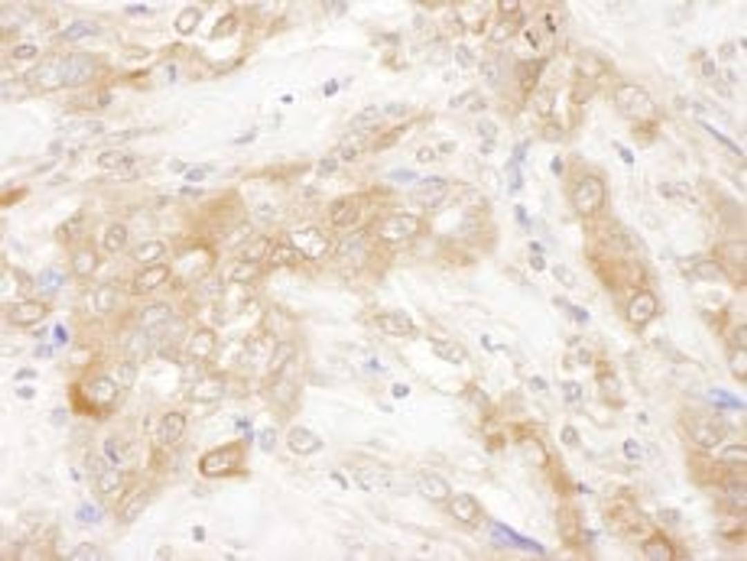 Detection of human CHMP2B by immunohistochemistry.