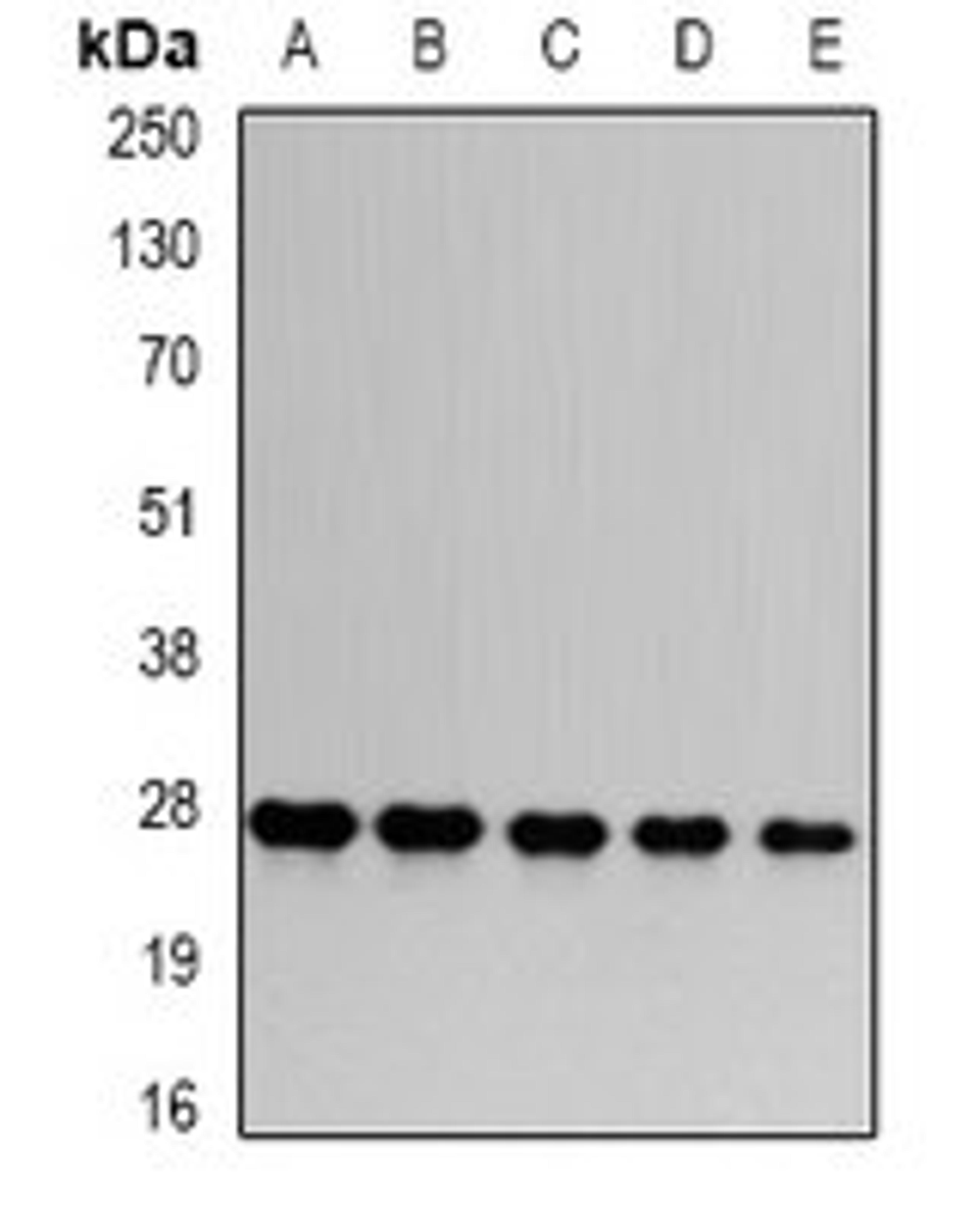 Western blot analysis of HepG2 (Lane1), Hela (Lane2), mouse skeletal muscle (Lane3), PC12 (Lane4), COS7 (Lane5) whole cell lysates using PSMA6 antibody