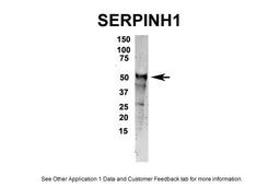 Antibody used in IP on Human, Mouse, Rat.