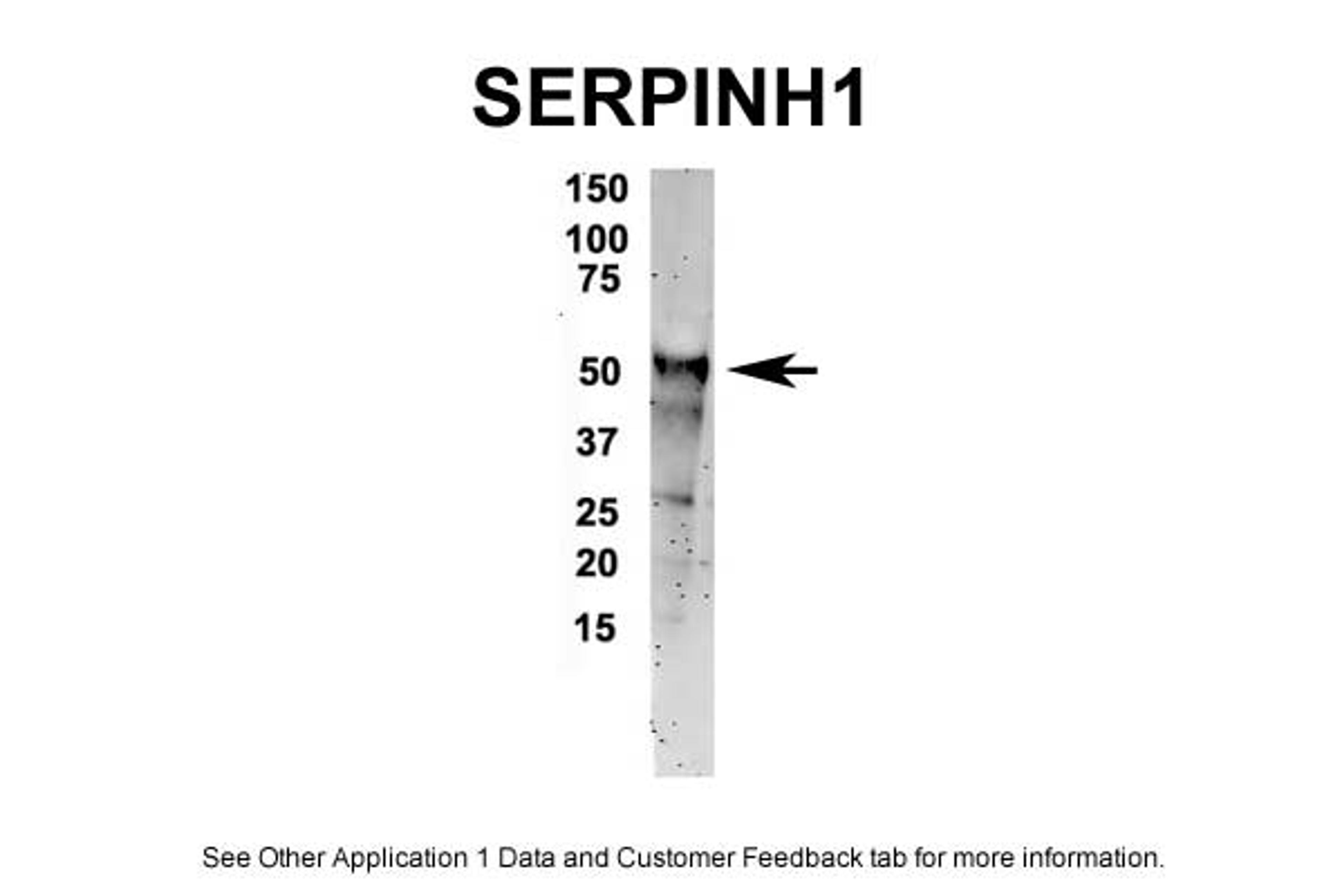 Antibody used in IP on Human, Mouse, Rat.