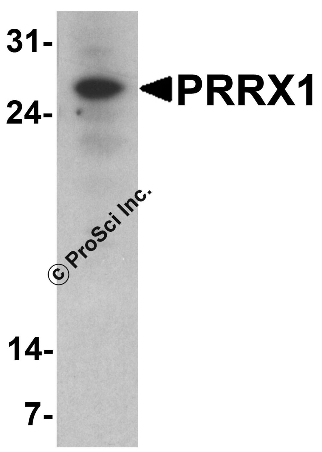 Western blot analysis of PRRX1 in HeLa cell lysate with PRRX1 antibody at 1 μg/ml.