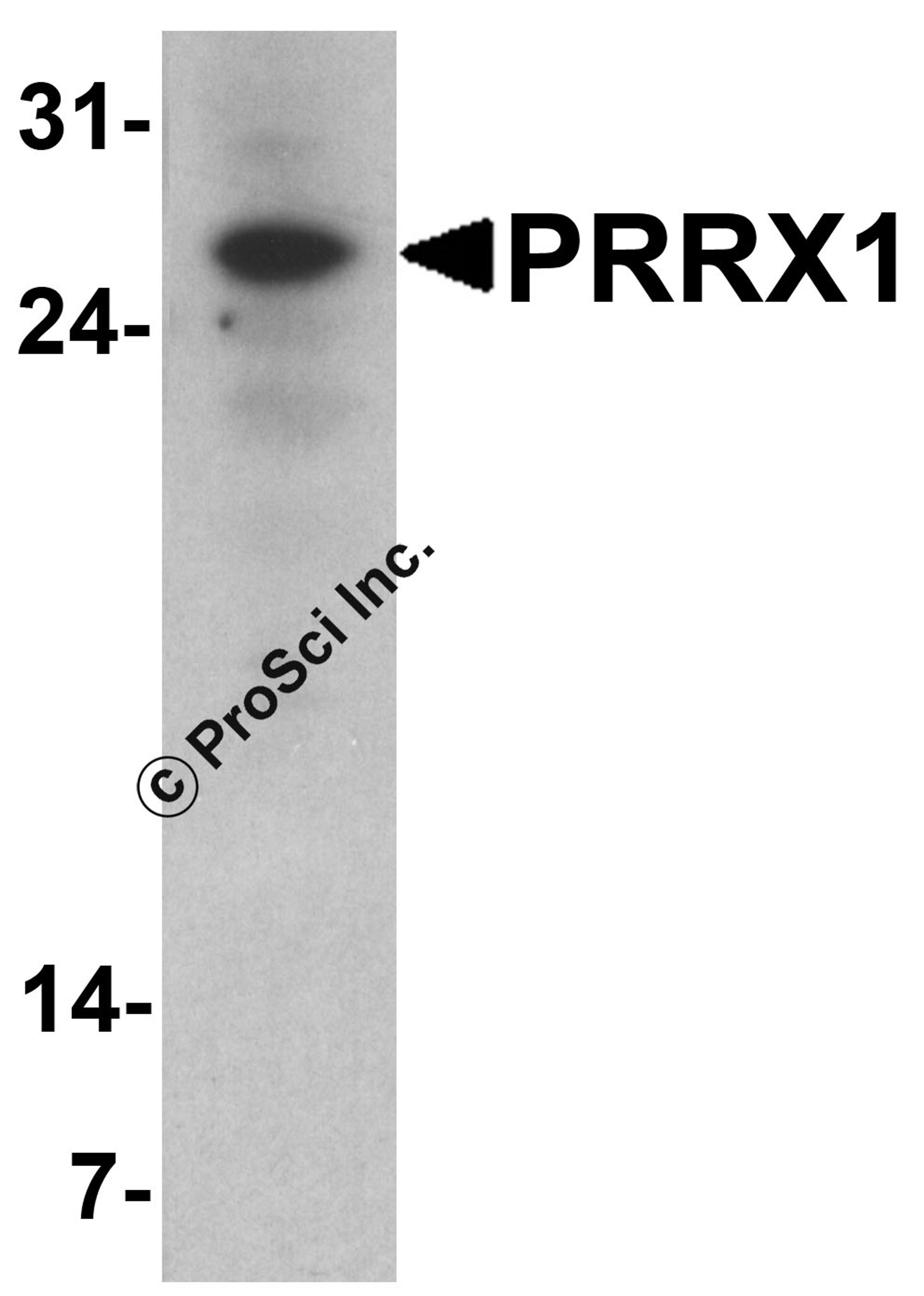 Western blot analysis of PRRX1 in HeLa cell lysate with PRRX1 antibody at 1 μg/ml.
