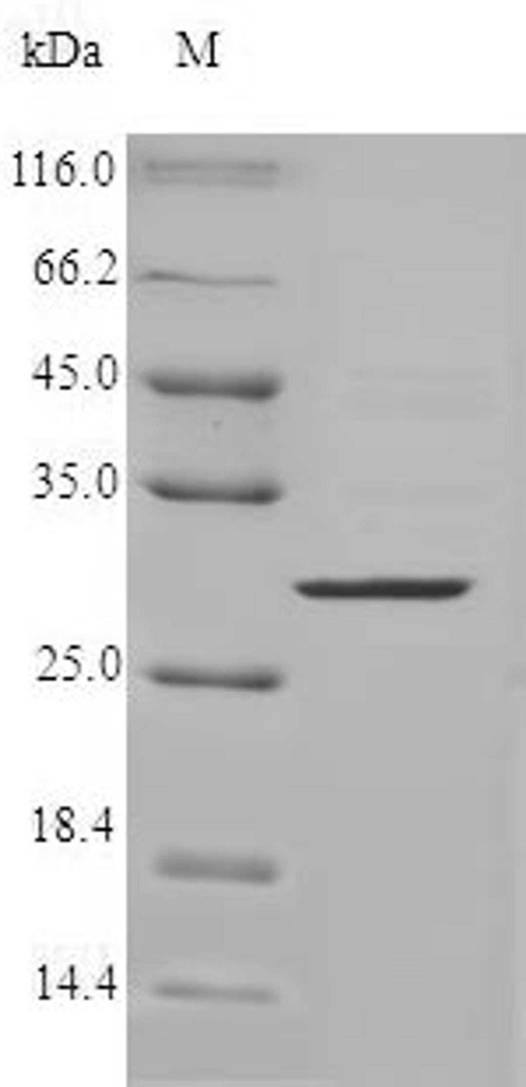 (Tris-Glycine gel) Discontinuous SDS-PAGE (reduced) with 5% enrichment gel and 15% separation gel.