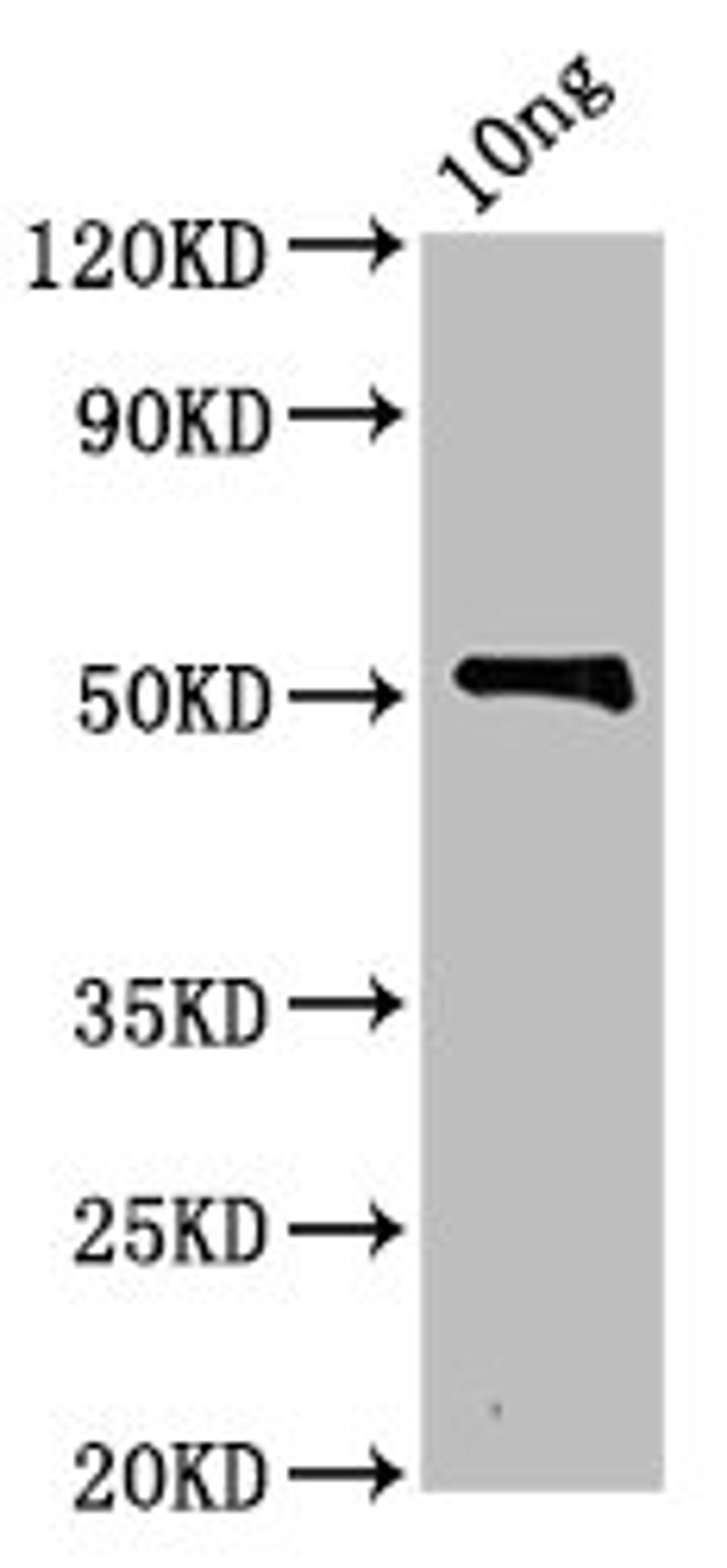 Western Blot. Positive WB detected in Recombinant protein. All lanes: zot antibody at 3.5ug/ml. Secondary. Goat polyclonal to rabbit IgG at 1/50000 dilution. Predicted band size: 52 kDa. Observed band size: 52 kDa. 