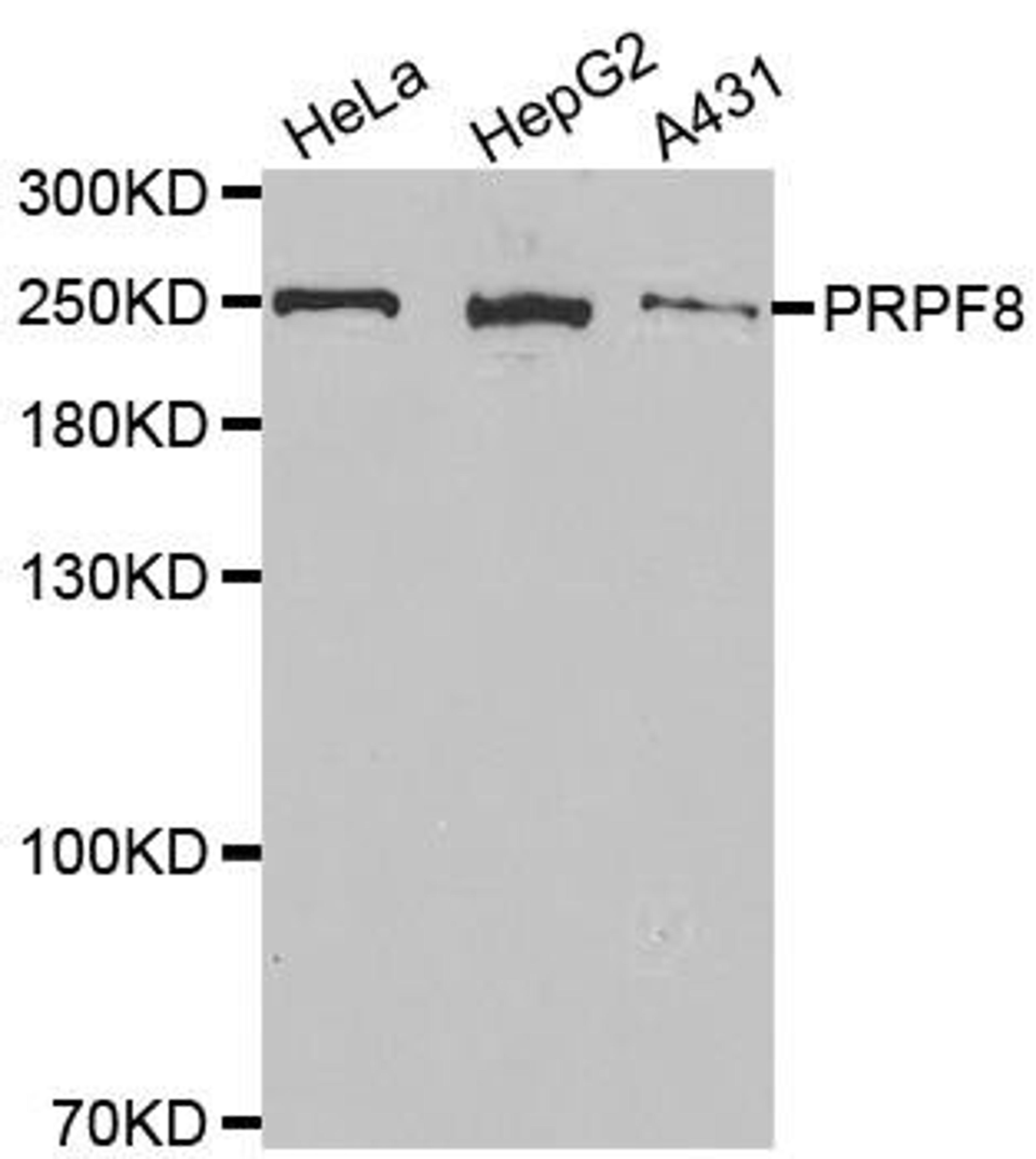 Western blot analysis of extracts of various cell lines using PRPF8 antibody