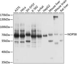 Western blot - NOP58 antibody (A14129)