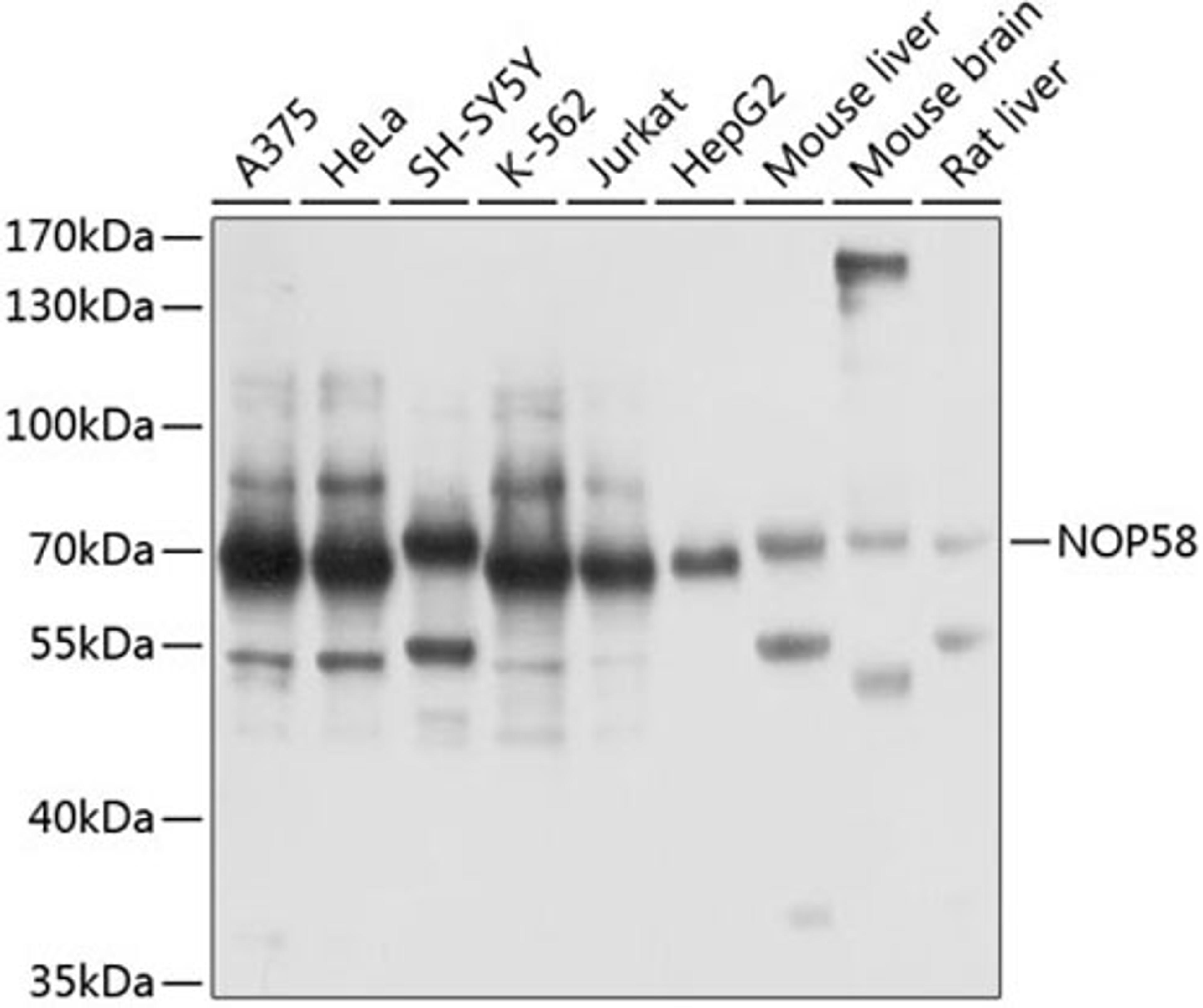 Western blot - NOP58 antibody (A14129)