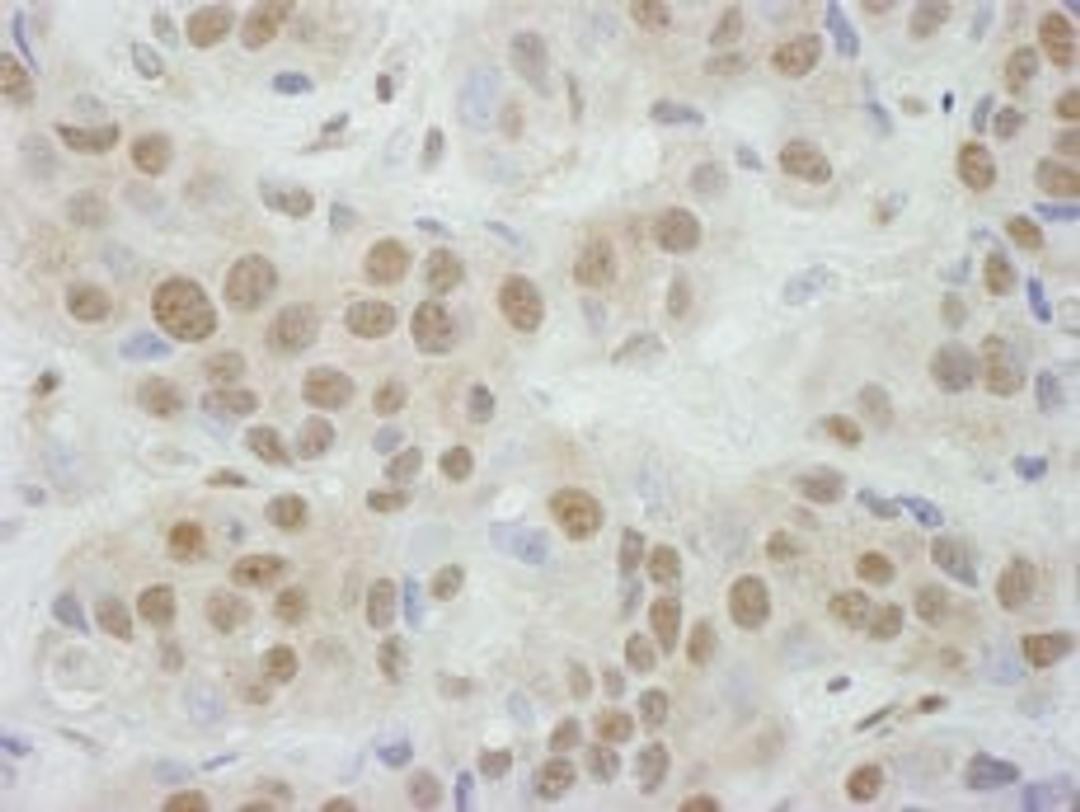 Detection of human TBP1 by immunohistochemistry.