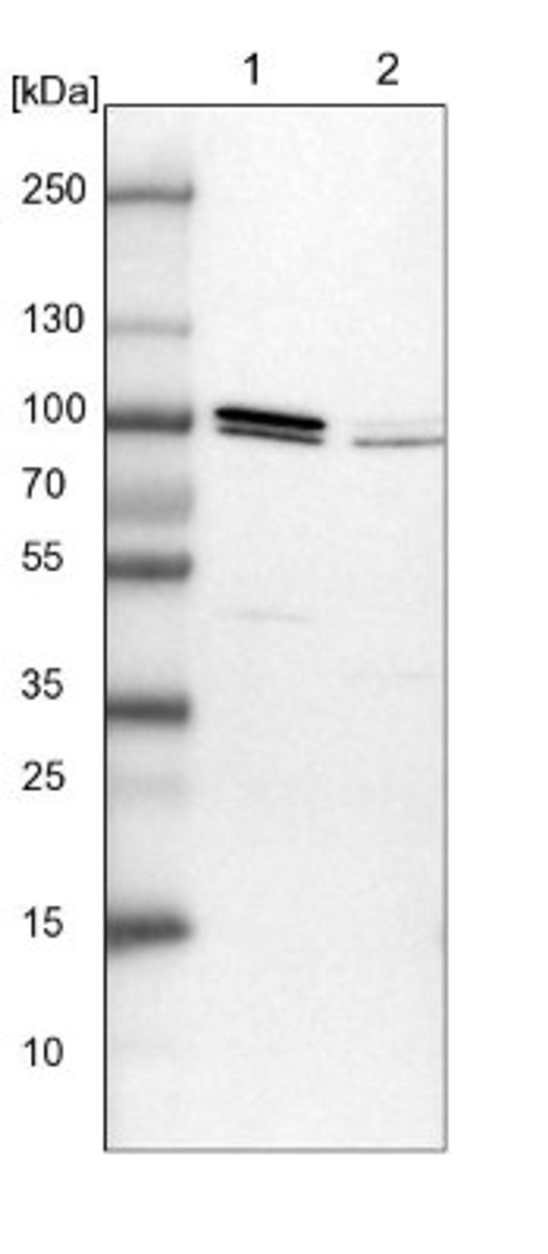 Western Blot: Apc5 Antibody [NBP1-90136] - Lane 1: NIH-3T3 cell lysate (Mouse embryonic fibroblast cells)<br/>Lane 2: NBT-II cell lysate (Rat Wistar bladder tumour cells)