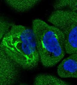 Immunocytochemistry/Immunofluorescence: alpha COP I Antibody [NBP1-89705] - Staining of human cell line A-431 shows positivity in cytoplasm, intermediate filaments & nucleus but excluded from the nucleoli. Antibody staining is shown in green.