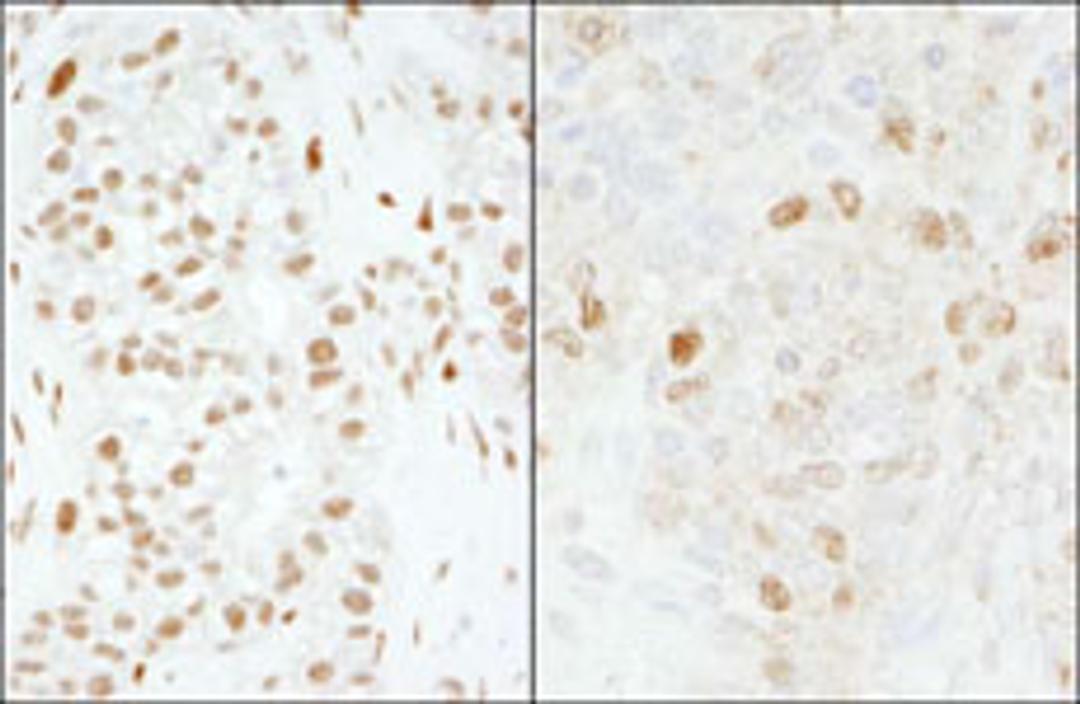 Detection of human and mouse FOXK1 by immunohistochemistry.