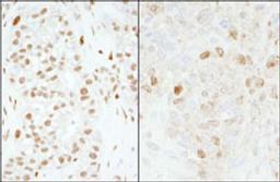 Detection of human and mouse FOXK1 by immunohistochemistry.