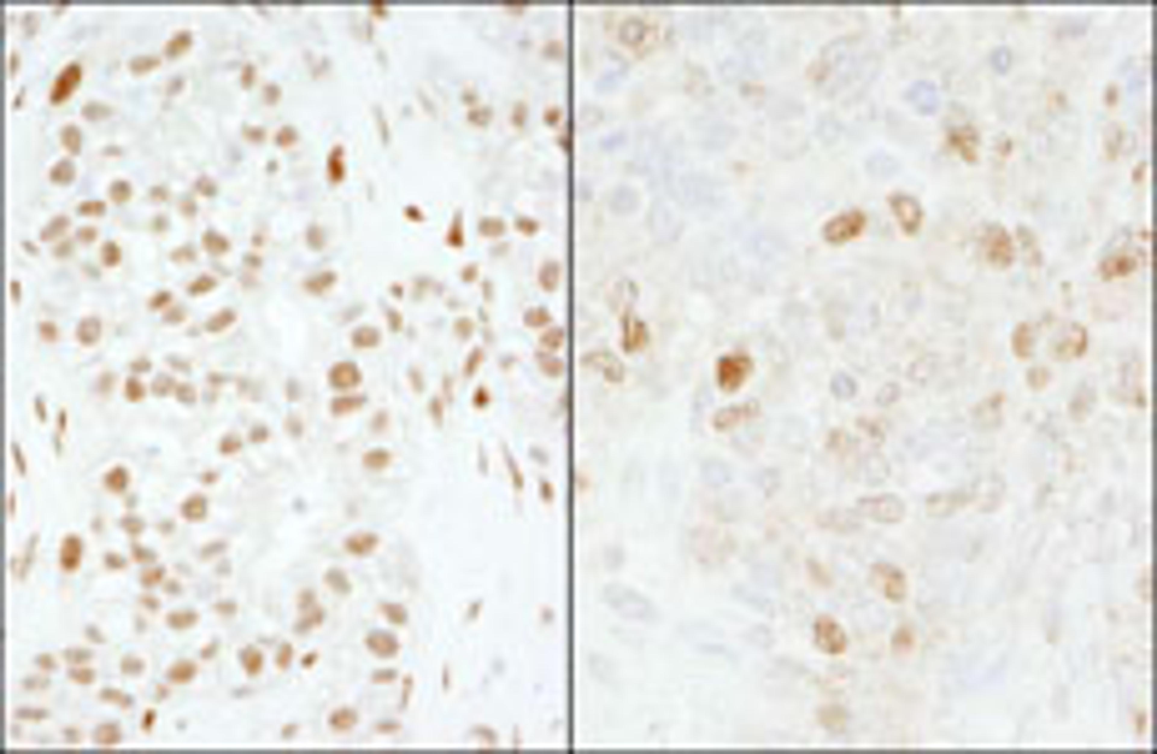 Detection of human and mouse FOXK1 by immunohistochemistry.