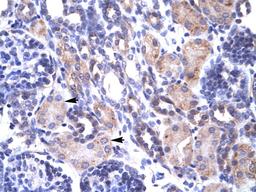 Antibody used in IHC on Human kidney.