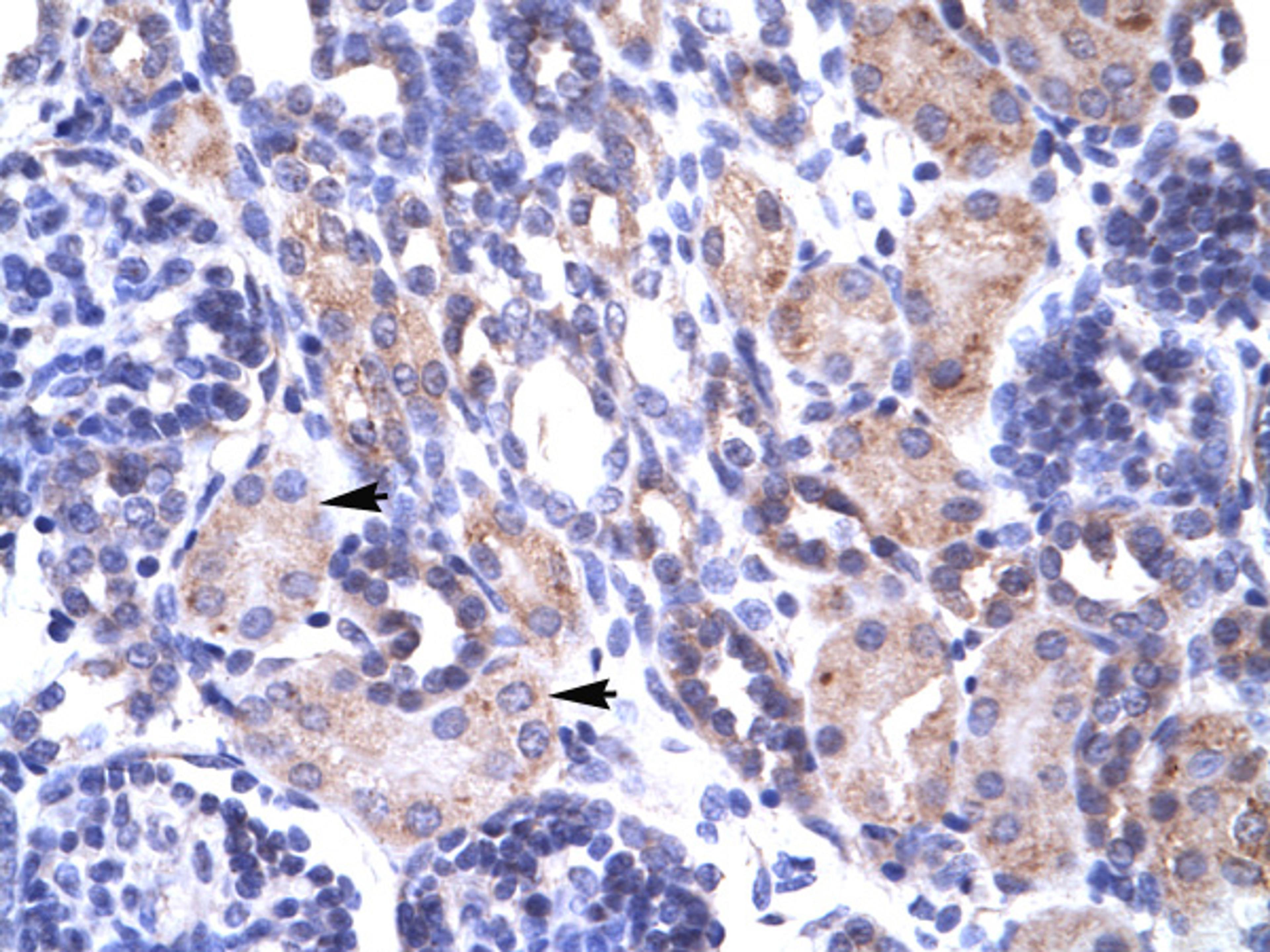 Antibody used in IHC on Human kidney.