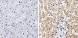 Immunohistochemistry-Paraffin: Cytochrome P450 1A1/1A2 Antibody (MC1) [NB100-74398] - Analysis showing positive staining in the cytoplasm and membrane of Human liver tissue (right) compared with a negative control in the absence of primary antibody (left).